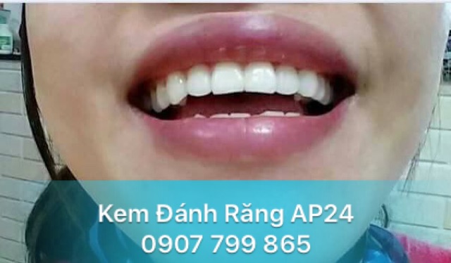 Kem đánh răng AP24 giúp răng trắng sáng, giảm vôi răng 110gr