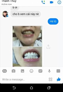 than hoạt tính trắng răng #tanoshi