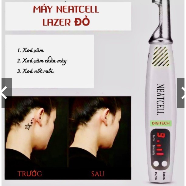 Máy Xóa Xăm, Tàn Nhan, Nám, Nốt Ruồi NEATCELL Cao Cấp