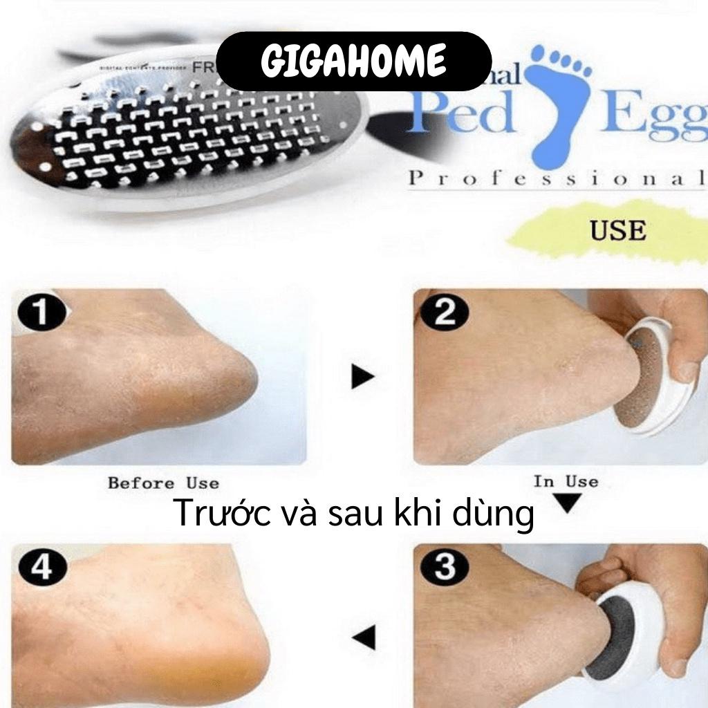 Mài gót  ️ GIÁ VỐN Mài gót EGG tẩy tế bào chết da chân, tạo gót chân mềm mịn hồng hào, bảo vệ sức khỏe đôi chân bạn 52