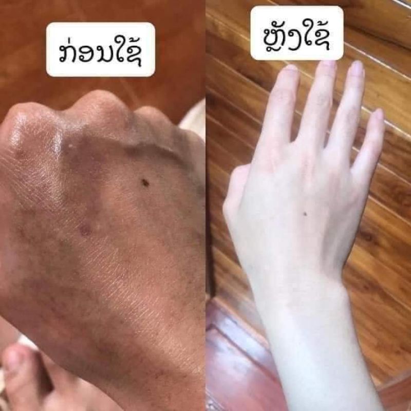 Boky Whitening Lotion🇱🇦 kem trắng da ko phải BB.