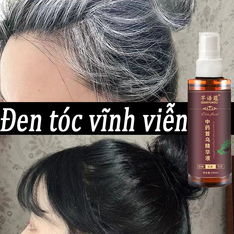 Xịt mọc tóc Dầu gội kích mọc tóc Tinh chất đen tóc 100ml chất thảo trắng chuyển đen chống rụng tóc dưỡng tóc