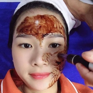 Cấy Hồng Sâm Baby