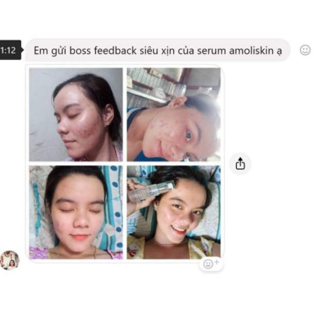 Serum Collagen Tái Tạo Da Amoliskin 30 ml | BigBuy360 - bigbuy360.vn