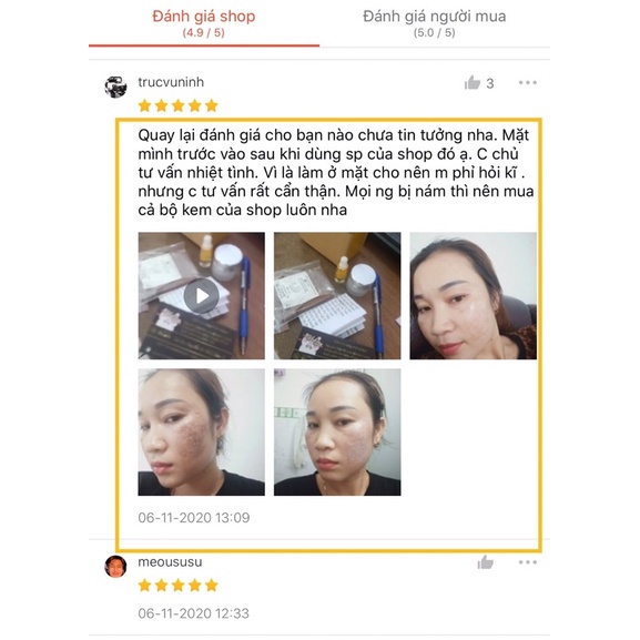 Thay Da Sinh Học Peel TCA Zenus