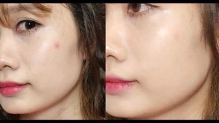 Miếng Dán Mụn Cosrx Clear Fit Master Patch