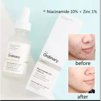 [Mã COS1904 giảm 8% đơn 300K] Tinh chất #THE_ORDINARY- Niacinamide 10% + Zinc 1% (chính hãng, date mới) | BigBuy360 - bigbuy360.vn