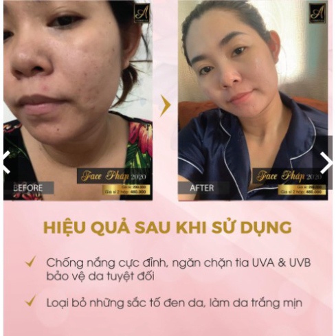 [GIÁ RẺ CHẤT LƯỢNG] [ CHÍNH HÃNG ] [CHÍNH HÃNG] Kem face pháp chữ A Mềm - Giúp ngăn ngừa mụn, thâm nám tàn nhang,Hiệu qu | BigBuy360 - bigbuy360.vn