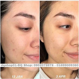 SERUM C DƯỠNG SÁNG DA, MỜ THÂM