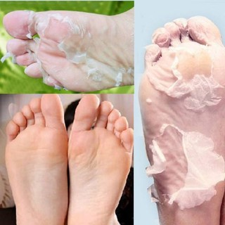 Tế Bào Chết Da Chân To-Plan Lavender Foot Care Pack.