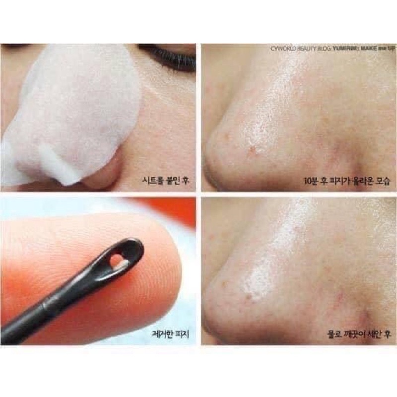 Mặt Nạ Serum Đẩy Mụn Đầu Đen Good Bye Blackhead Ciracle tặng kèm que nặn mụn chính hãng