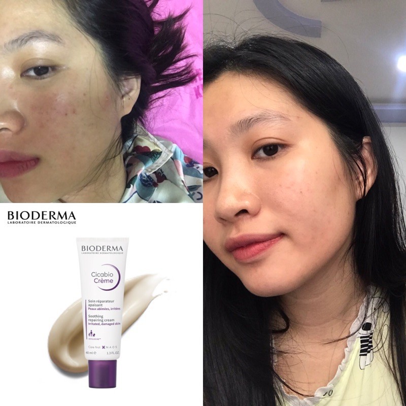 Kem Dưỡng Ẩm Phục Hồi Và Làm Dịu Da Tổn Thương Bioderma Cicabio Crème | BigBuy360 - bigbuy360.vn