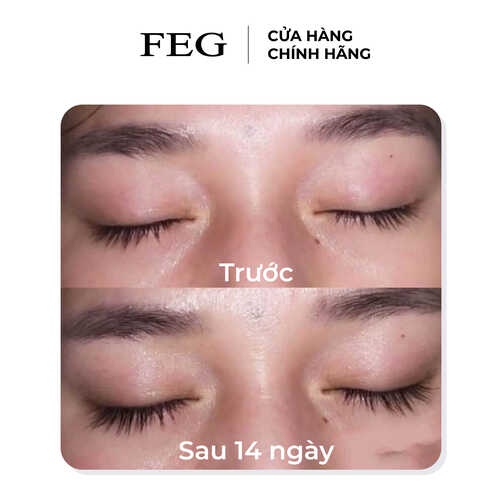 DƯỠNG MI FEG PRO ADVANCED ĐẸP HƠN DÀI HƠN (CHÍNH HÃNG)