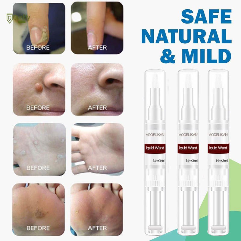 Dung dịch loại bỏ mụn thịt dư an toàn hiệu quả 13ml