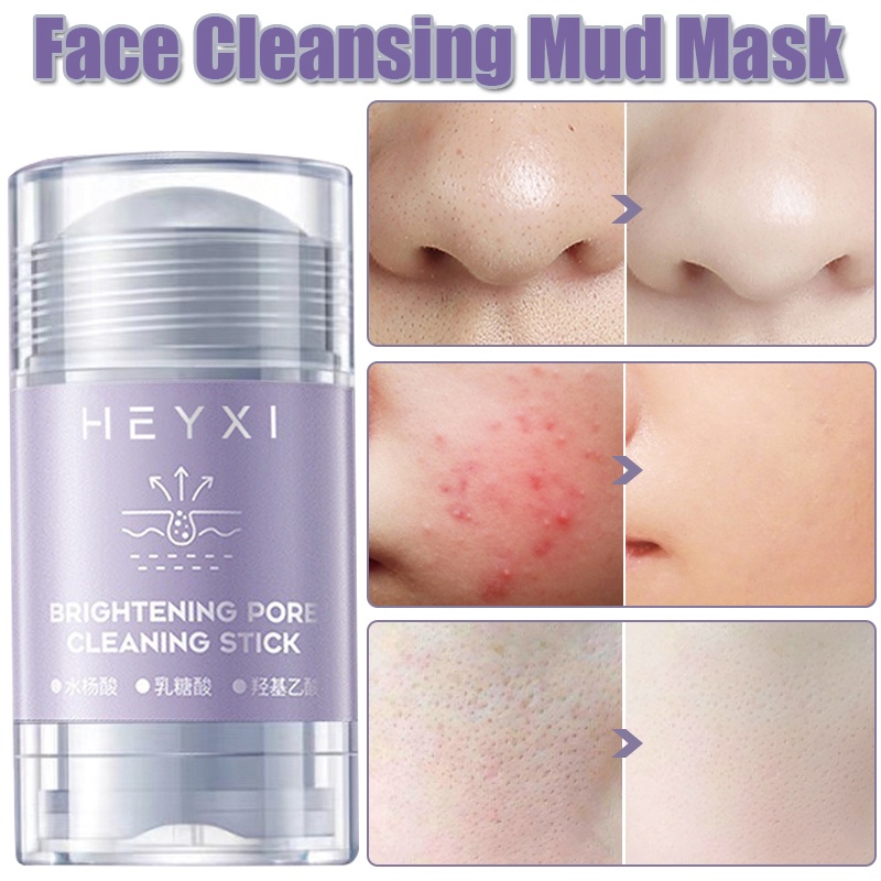 Mặt Nạ Làm Sạch Mụn Đầu Đen / Se Khít Lỗ Chân Lông / Giúp Giảm Mụn Hiệu Quả Mặt Nạ Bùn