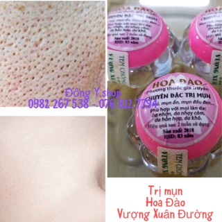 Set 5 hộp kem mụn Hoa Đào Vượng Xuân Đường