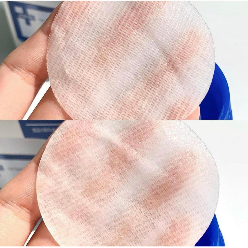 Pad chăm sóc da mụn ISOI 1ST SPEEDY SPOT PAD