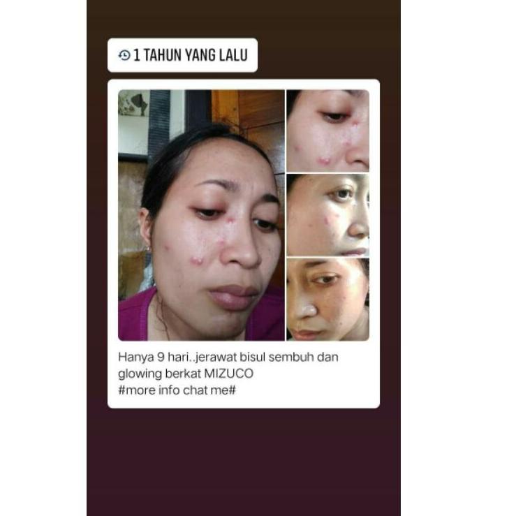 ⭐ Xịt Cố Định Mizuco (Bộ 139) (trims,.)