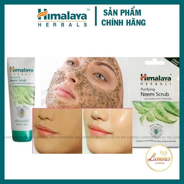 Tẩy Da Chết Himalaya Neem Nghệ Cho Da Dầu Mụn, Giảm Mụn Cám, Mụn Đầu Đen, Mụn Ẩn | Himalaya Purifying Neem Scrub 100ml