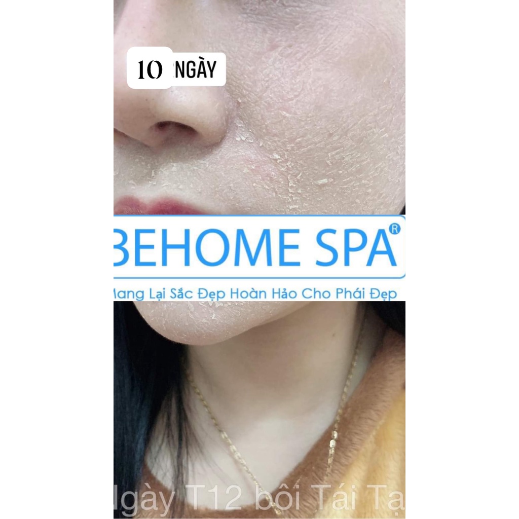 Peel da Behome Spa thay da sinh học giảm thâm mụn nám tàn nhang 20g Galaxy Beauty