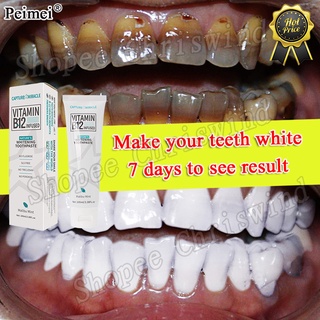 Kem đánh răng PeiMei Vitamin loại bỏ vết bẩn làm trắng răng hiệu quả 100g