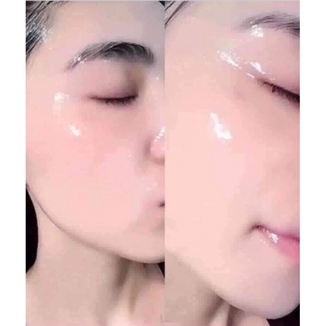 Mặt Nạ Tế Bào Gốc Nhau Thai Cuống Rốn Rwine Beauty