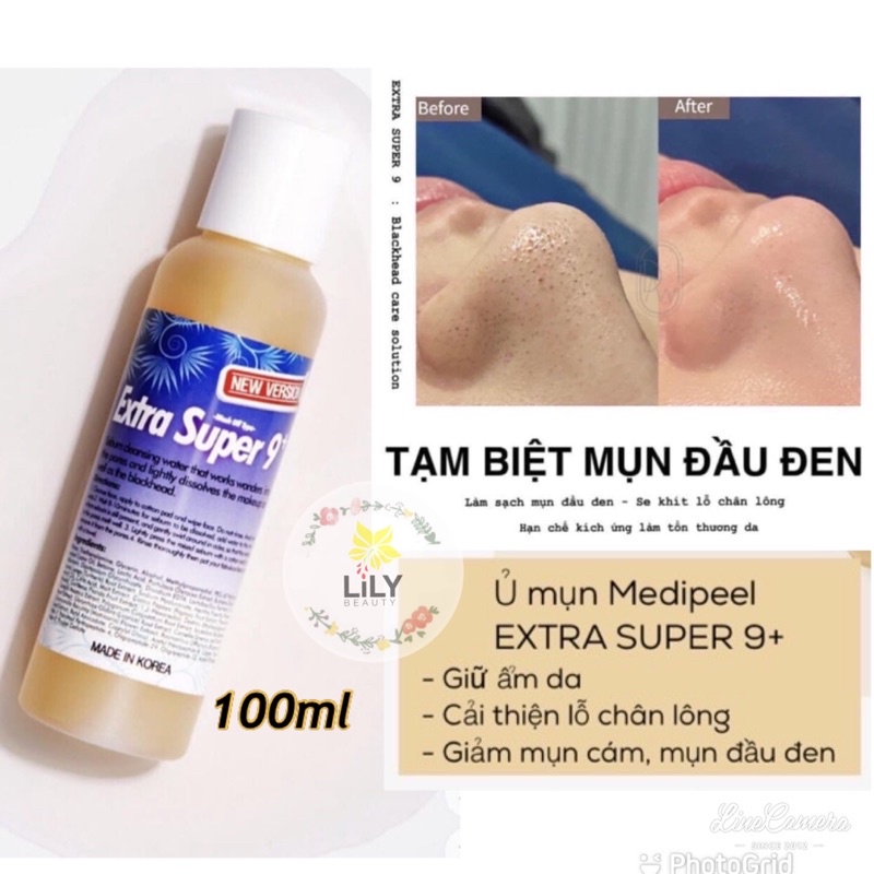 Ủ mụn Medipeel chai 100ml