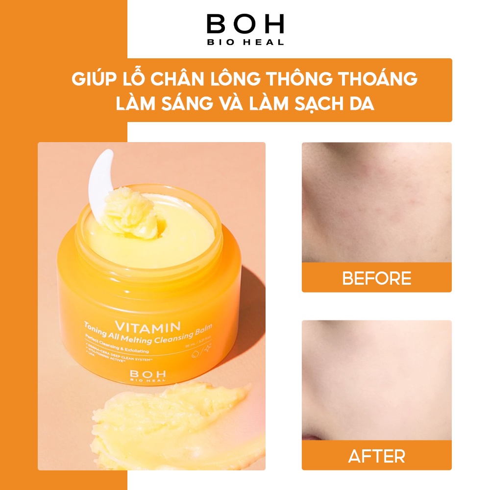 Sáp Tẩy Trang BIOHEAL BOH Vitamin Toning All Melting Cleansing Balm 95ml