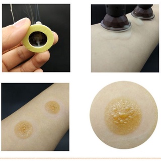 Hộp 50 điếu nhang ngải cứu kèm đế dán vào huyệt đạo.Cốc dán cứu ngải