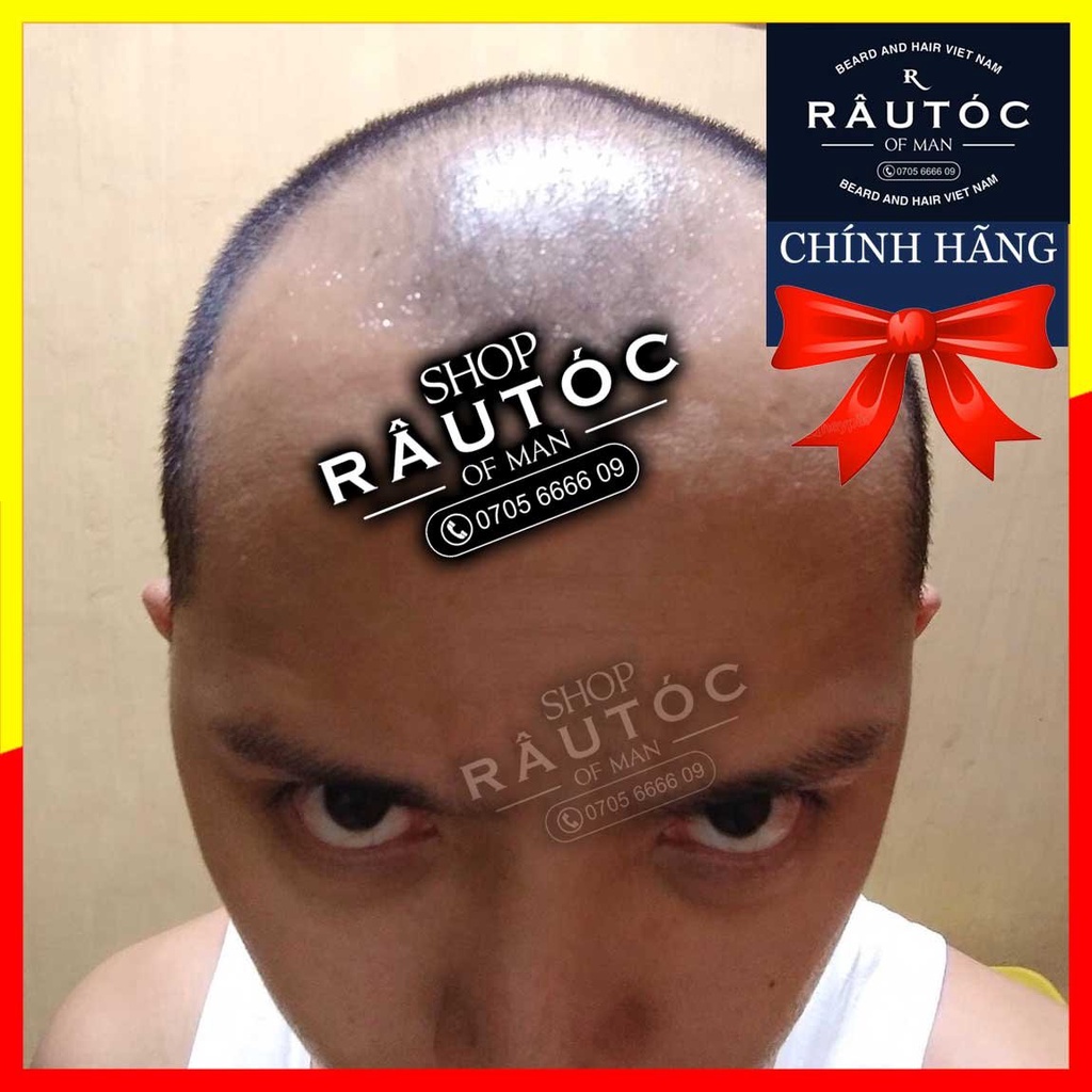 Minoxidil 5% dạng lỏng chính hãng Mỹ tặng 1 ống LCLT