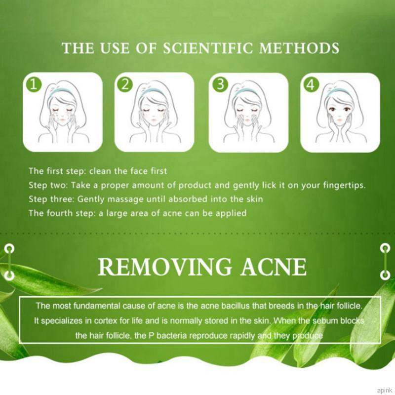 [Hàng mới về] Kem Giảm Mụn Dưỡng Ẩm Thu Nhỏ Lỗ Chân Lông Làm Săn Chắc Da 20g