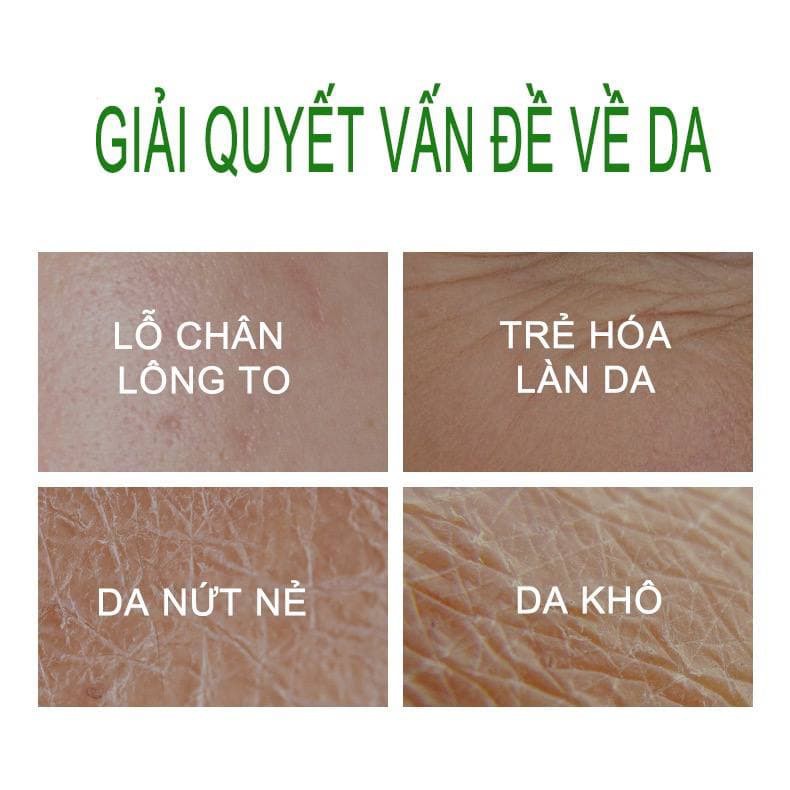 Combo 5 gói Mặt Nạ Ngủ Rau Má tái tạo da mờ vết thâm giảm viên ngăn ngừa mụn