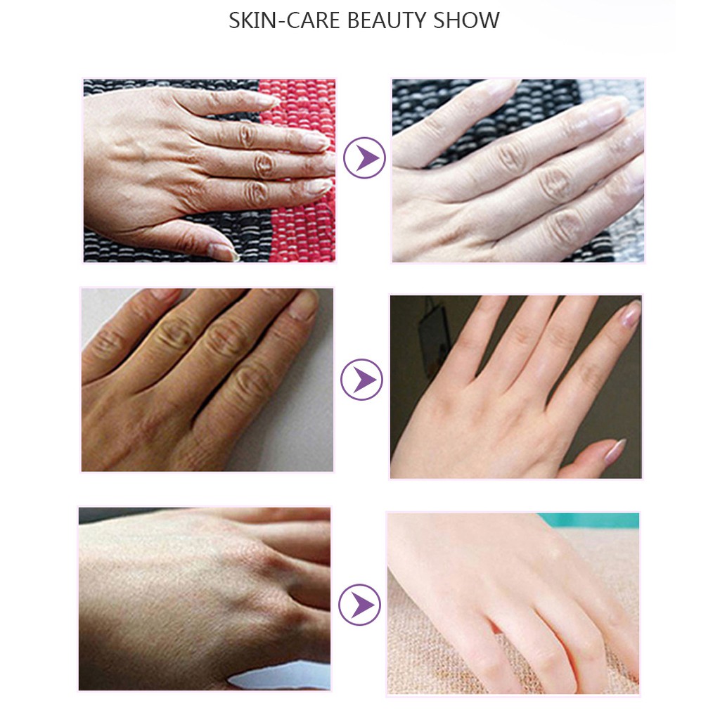 Mặt nạ tẩy tế bào chết cho da tay EFERO dưỡng ẩm chống lão hóa | BigBuy360 - bigbuy360.vn