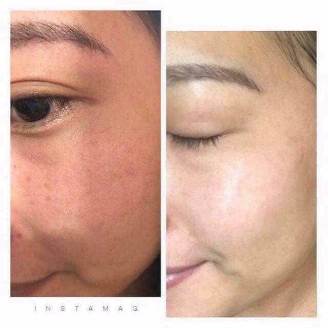 [Mã COS1904 giảm 8% đơn 300K] Kem Mess Civasan tái sinh thần tốc cho da mỏng yếu nhạy cảm 10g, 35g | BigBuy360 - bigbuy360.vn