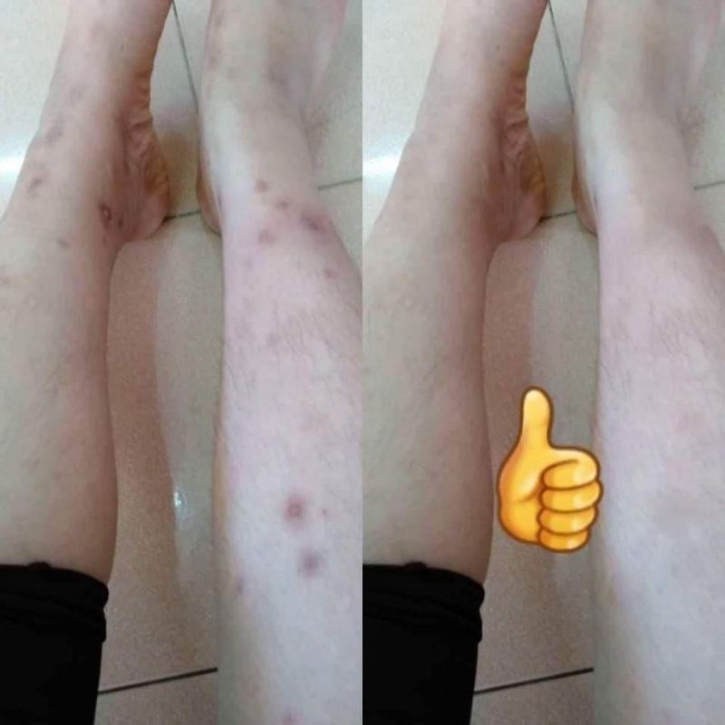 SERUM mờ thâm đa năng phúc minh tâm HÀNG CHÍNH HÃNG | BigBuy360 - bigbuy360.vn