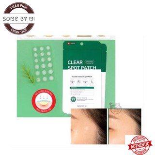 Miếng dán hỗ trợ giảm mụn "thần kỳ' some by mi clear spot patch