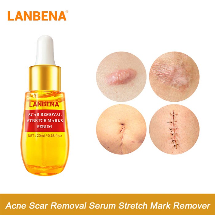 [Mã LUCIEN100 Giảm 10% Đơn 110k] LANBENA Serum Làm Mờ Sẹo Chiết Xuất Thảo Dược Làm Mờ Rạn Da Sẹo Lâu Năm