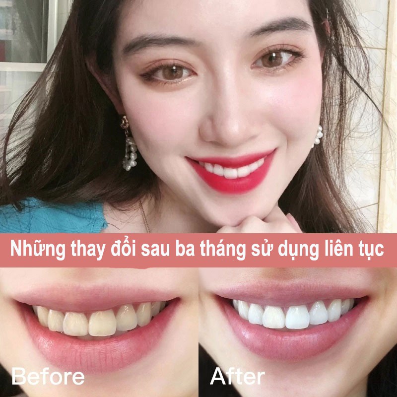 Kem Đánh Răng RNW Thiết Kế Cao Cấp 100g