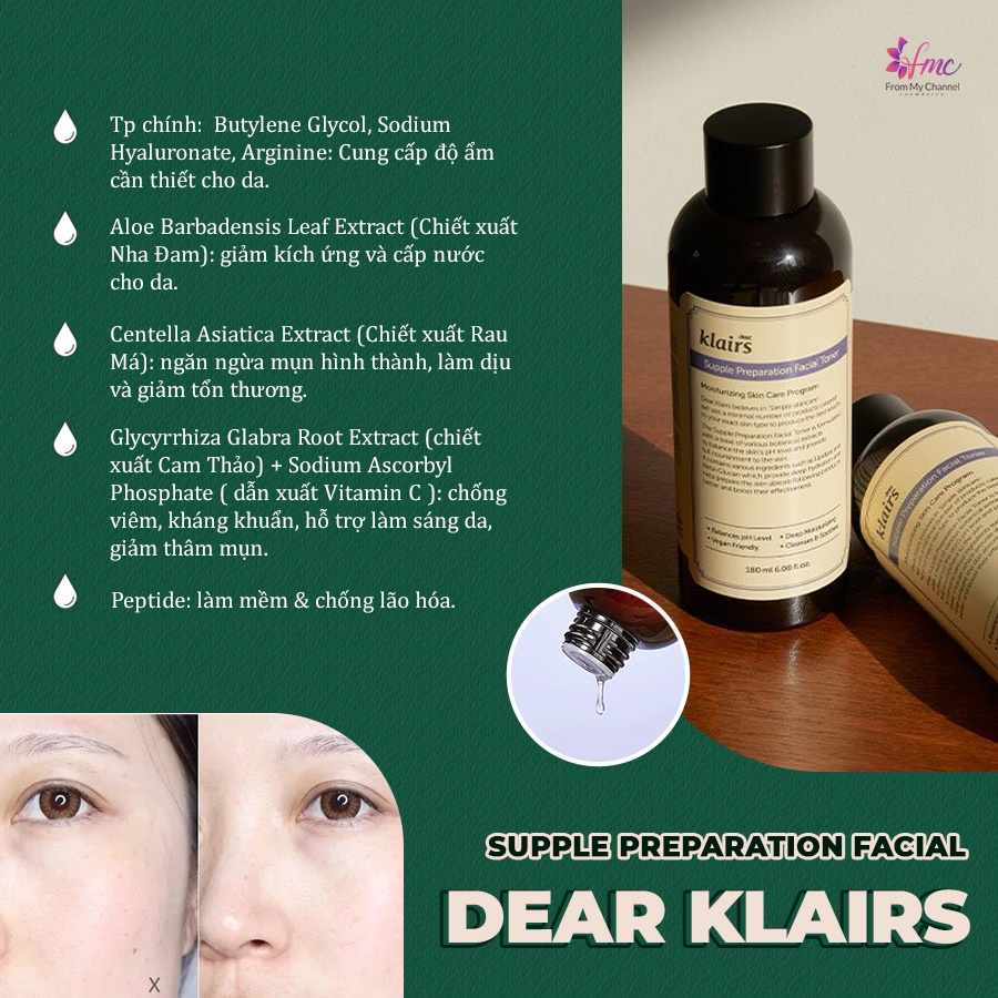 Toner Dear Klairs Dành Cho Da Treatment Làm Dịu và Cấp Ẩm+ Tặng 1 túi chườm giảm đau bụng