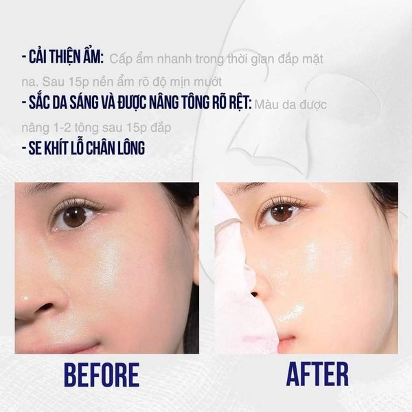 Mặt Nạ Dưỡng Trắng Cấp Ẩm &amp; Chống Lão Hóa Sur.Medic+ Mẫu Mới- Tách lẻ 1 miếng