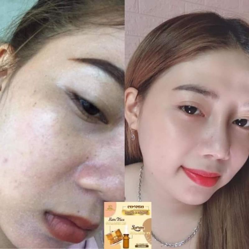 FACE COLLAGEN X3 TRẮNG DA NGỪA THÂM NÁM, MP ĐÔNG ANH CHÍNH HÃNG | BigBuy360 - bigbuy360.vn