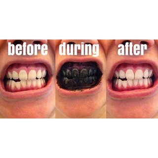 Than Hoạt Tính Trắng Răng SMILE UP