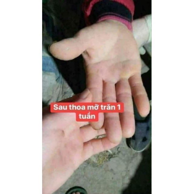 Mỡ Trăn Triệt lông Nguyên Chất N'STORE By Thanh Nhi - Chăm sóc da hiệu quả, NPP GBION | BigBuy360 - bigbuy360.vn