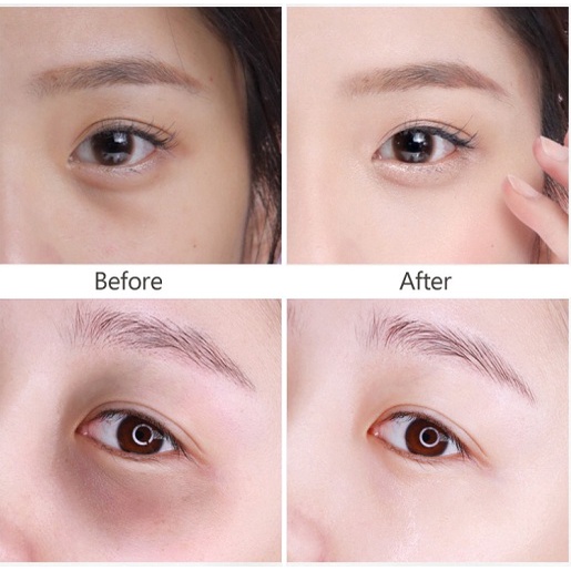 Kem mắt ngừa thâm làm mờ nếp nhăn mắt Meishoku Whitening Eye Cream Nhật Bản