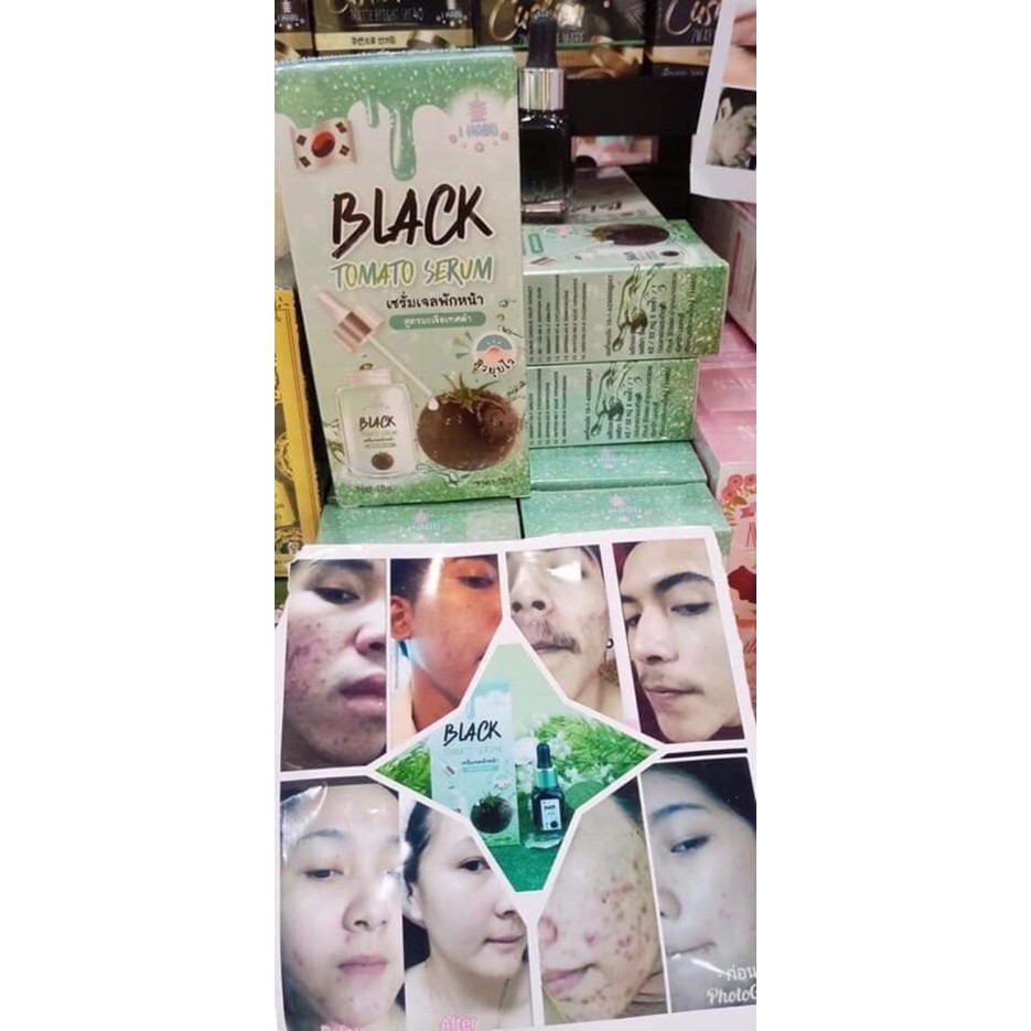 01 Serum Cà chua đen BLACK TOMATO Thái Lan 15gram