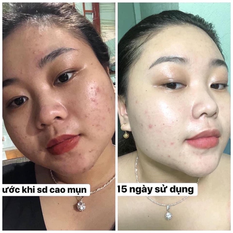 Cao lá nam ( mua trên 5 tặng 1 ) | BigBuy360 - bigbuy360.vn