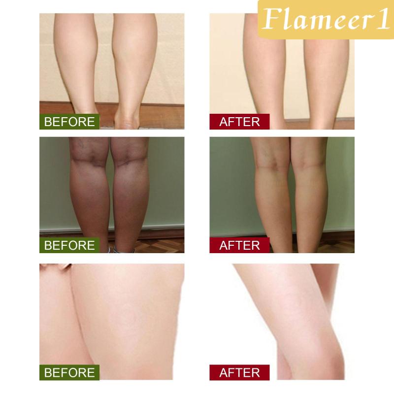 [Flameameer1] Túi Ngâm Chân Cây Ngải Trung Hoa Truyền Thống Chịu Lực Tốt Cho Sức Mạnh 1