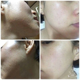 Toner BINGASUI MEISHOKU Nhật Bản