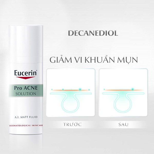 EUCERIN KEM DƯỠNG KIỀM DẦU, GIẢM MỤN PRO ACNE A.I MATT FUID 50ML