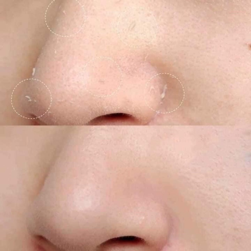 [Chính Hãng] 𝗧𝗔̂̉𝗬 𝗧𝗘̂́ 𝗕𝗔̀𝗢 𝗖𝗛𝗘̂́𝗧 𝗥𝗢𝗦𝗘𝗧𝗧𝗘 𝗡𝗛𝗔̣̂𝗧 𝗕𝗔̉𝗡 mẫu mới